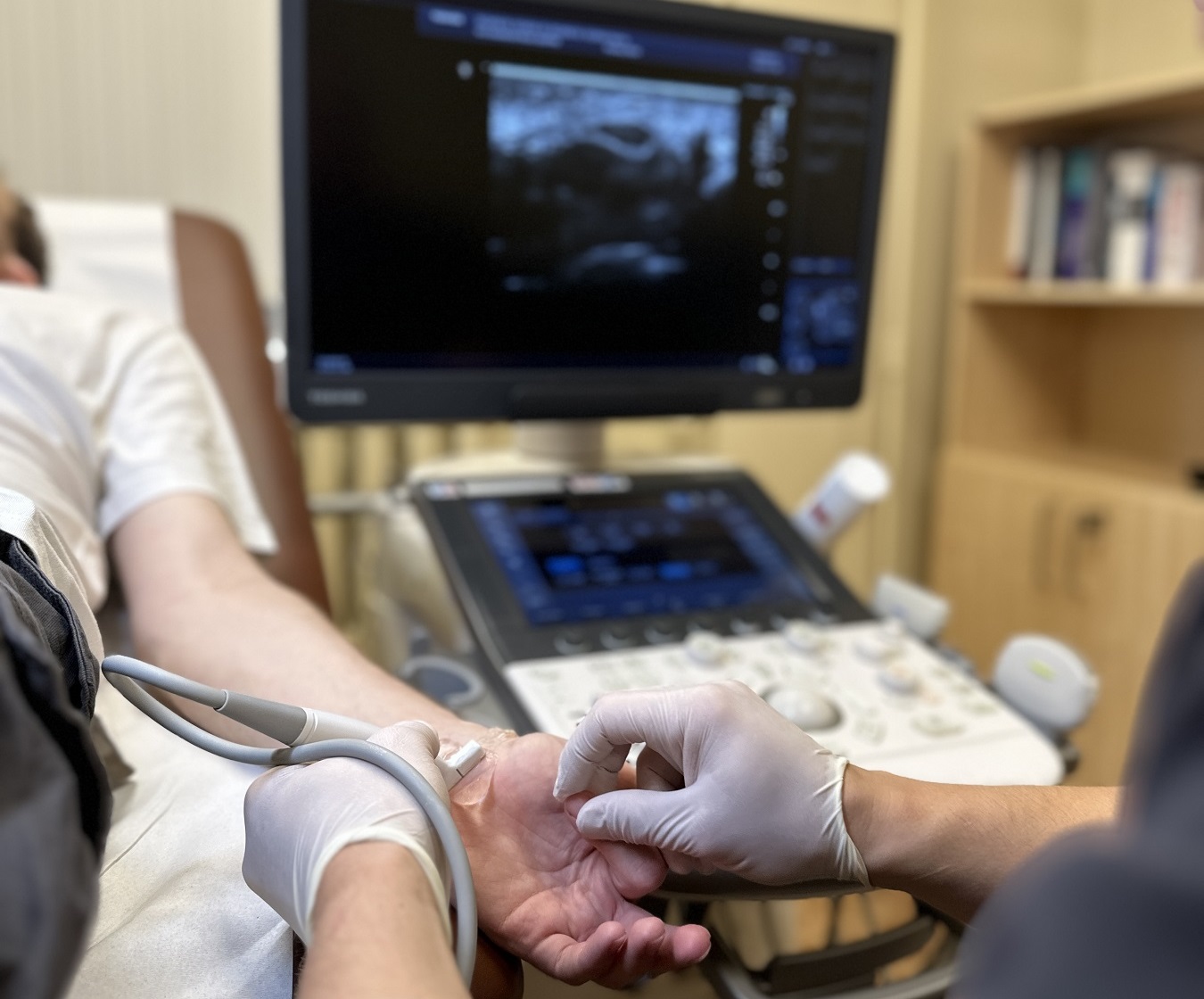 minimali-invazivas-plaukstas-un-pirkstu-proceduras-ultrasonografijas-kontrole